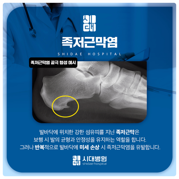 발뒤꿈치와 발바닥 부위에 나타나는 통증을 설명하는 이미지