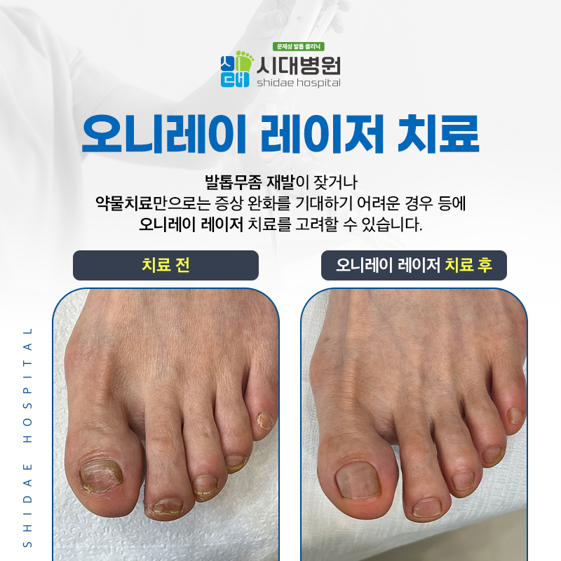 발과 발톱 상태를 확인하며 치료 방향을 살펴보는 족부 진료 이미지
